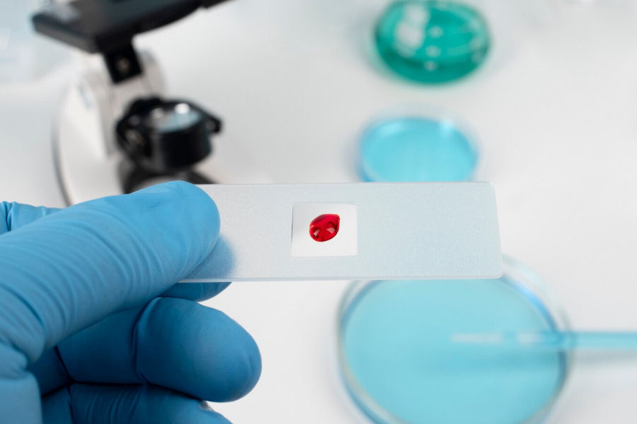 Prenotazione Test Genetico per la trombofilia ereditaria