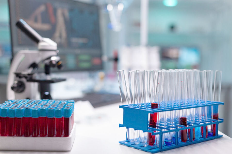 APCR - RESISTENZA ALLA PROTEINA C ATTIVATA