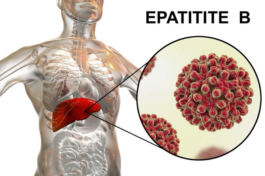 Epatite B (HBV)