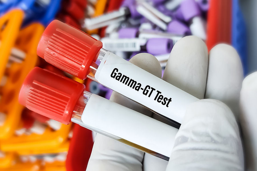 Gamma Glutamil Transferasi - GGT