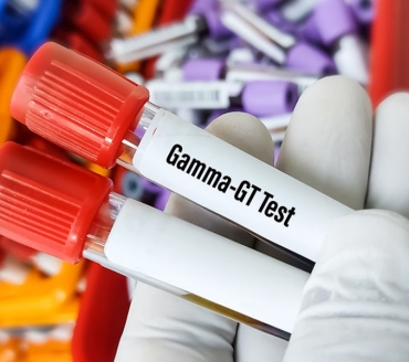 Gamma Glutamil Transferasi - GGT