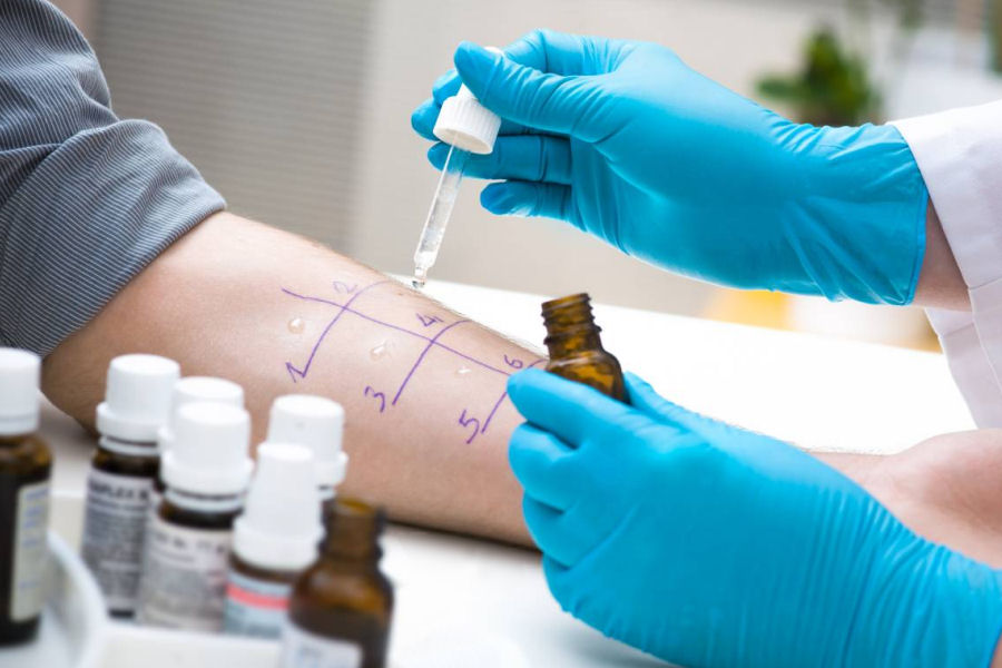 Prick Test