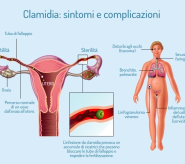 La Clamidia (Chlamydia trachomatis)