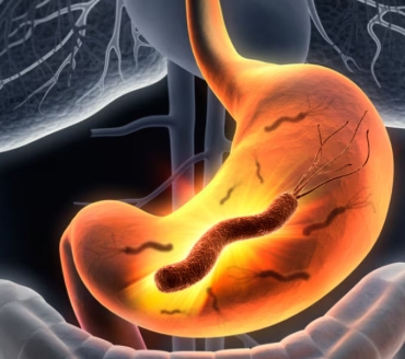Infezione da Helicobacter pylori 
