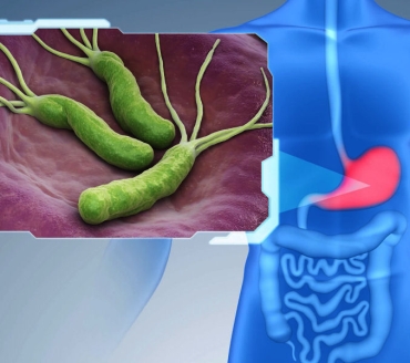 Test molecolare per la diagnosi infezione da Helicobacter pylori  e resistenza antibiotica 