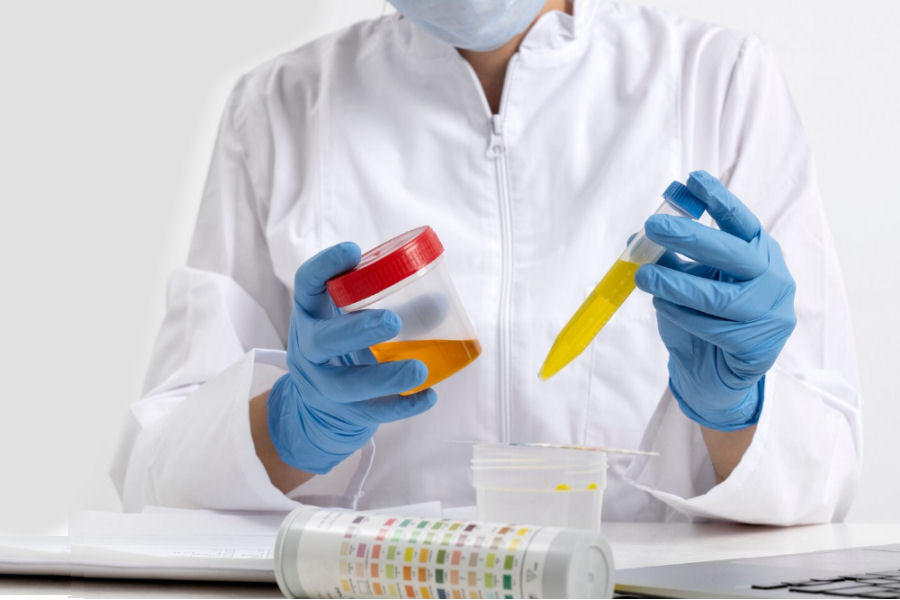 Test di gravidanza su urine